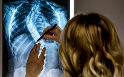How Chiropractic Care Helps Correct Scoliosis